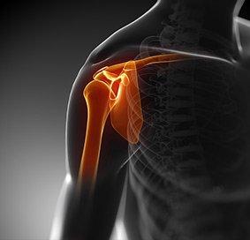 Arthroscopic Frozen Shoulder Release